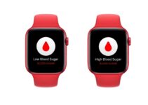 Apple Watch blood glucose monitoring is still a long way off